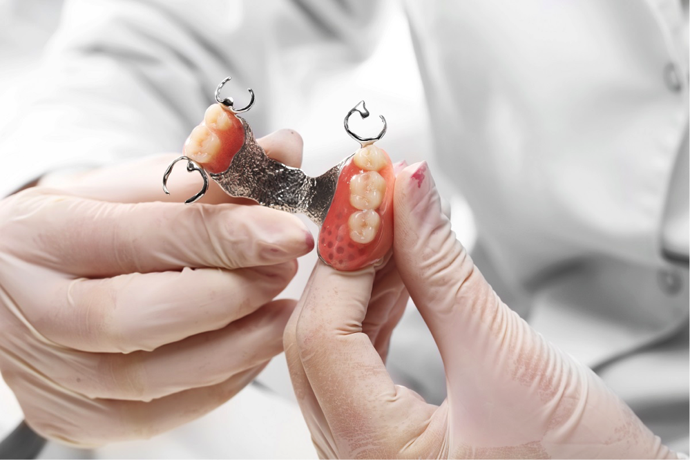 Interesting facts about dental implants and why they will work for you